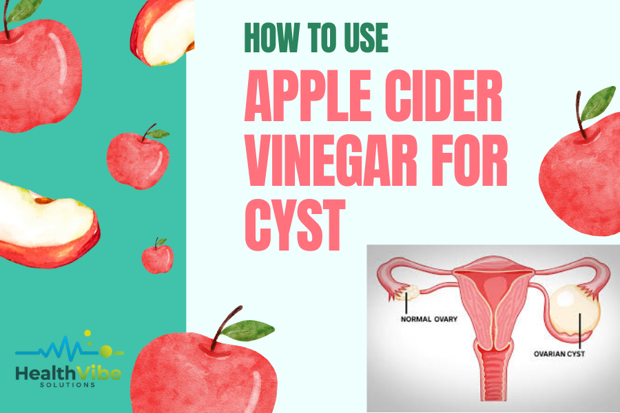 how to use apple cider vinegar for cyst